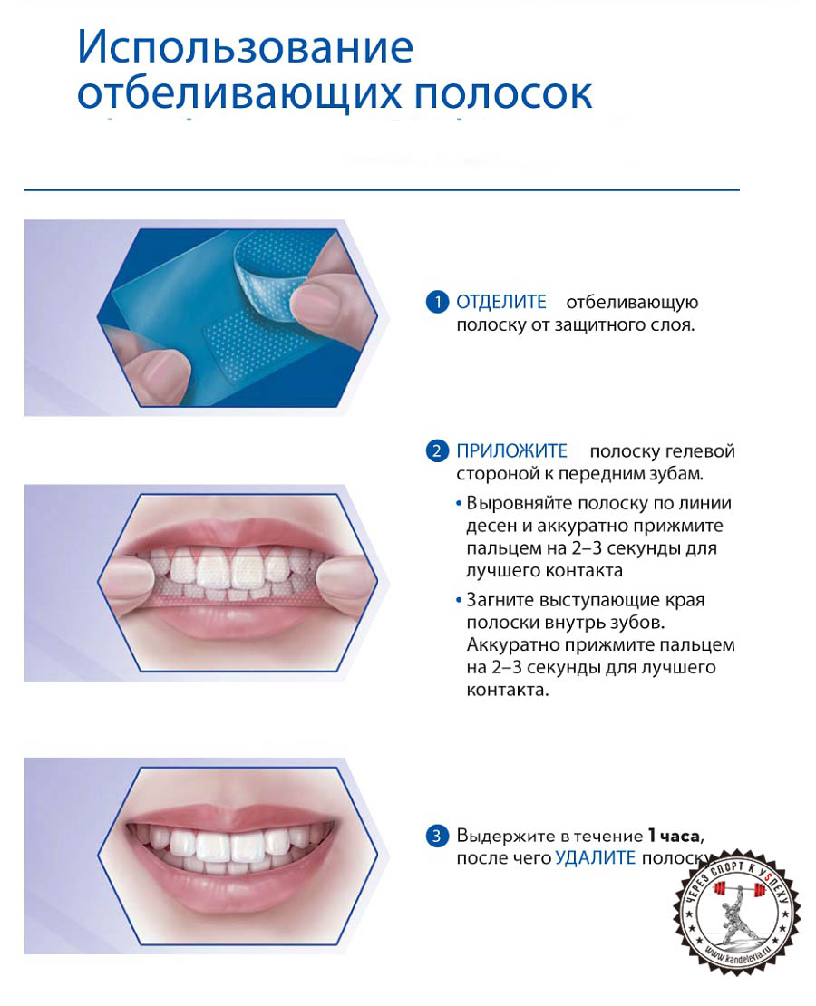 Кто отбеливал зубы полосками отзывы Кто отбеливал зубы полосками отзывы