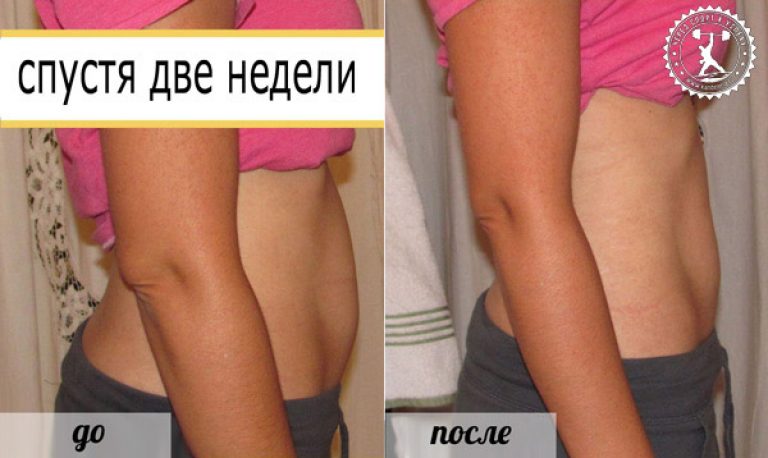 Обертывание для похудения уксусное в домашних условиях Обертывание для похудения уксусное в домашних условиях